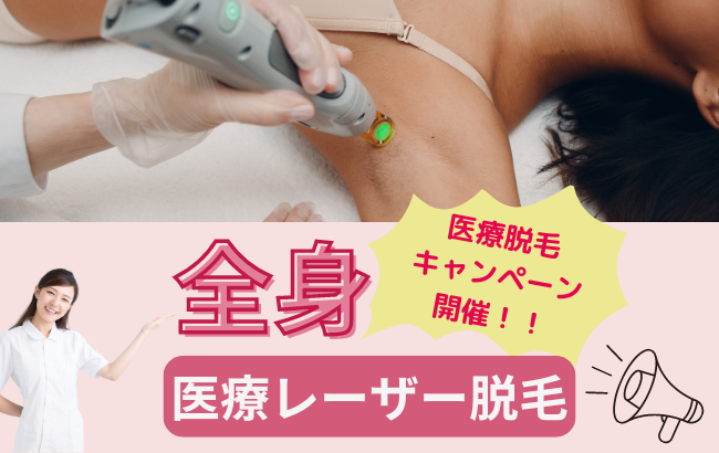 平日3名様限定》医療レーザー全身脱毛 ご予約受付中！！ - Raffineige